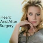 Amber Heard Before And After Plastic Surgery