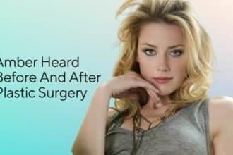 Amber Heard Before And After Plastic Surgery