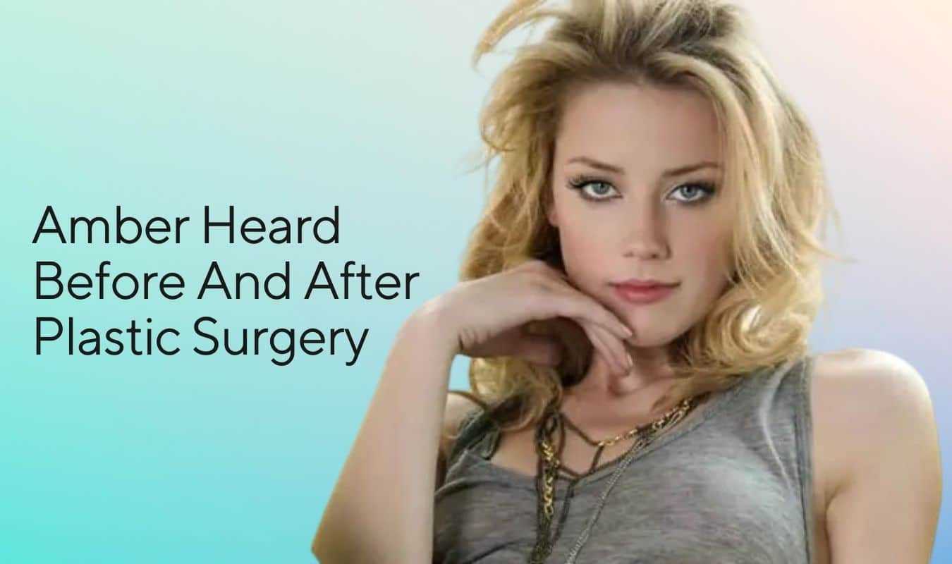 Amber Heard Before and After Plastic Surgery | Who confirmed it, How many surgeries and Many more