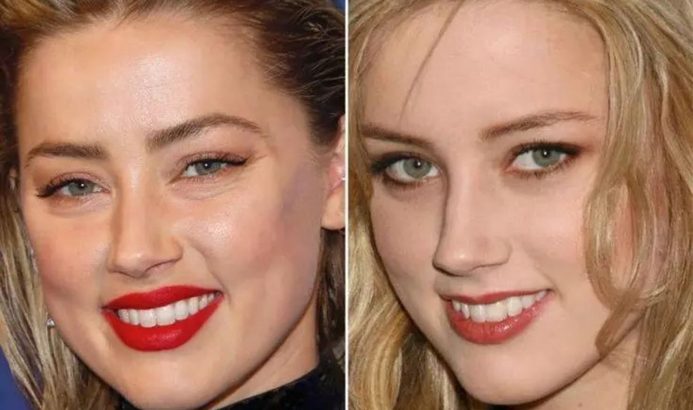 Amber Heard Before and After Plastic Surgery 1