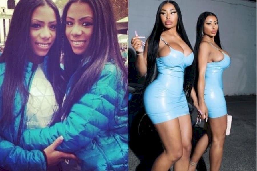 Clermont Twins Before and After