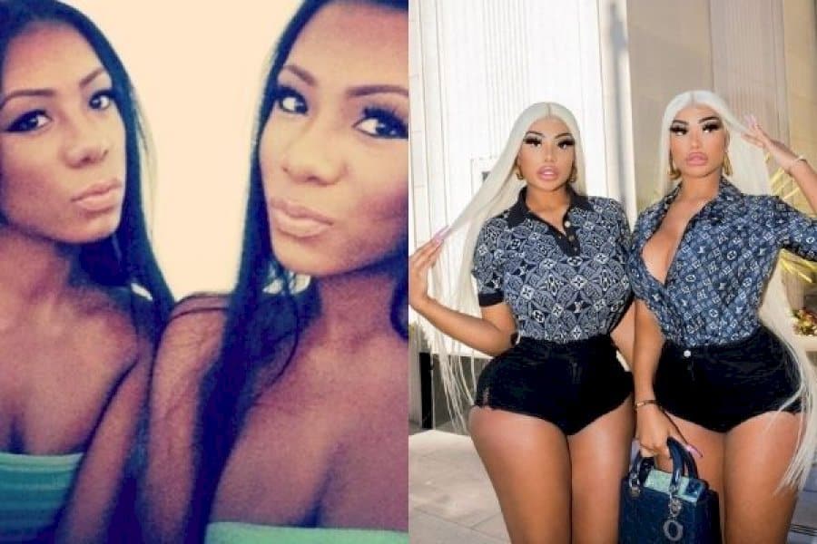 Clermont Twins Before and After