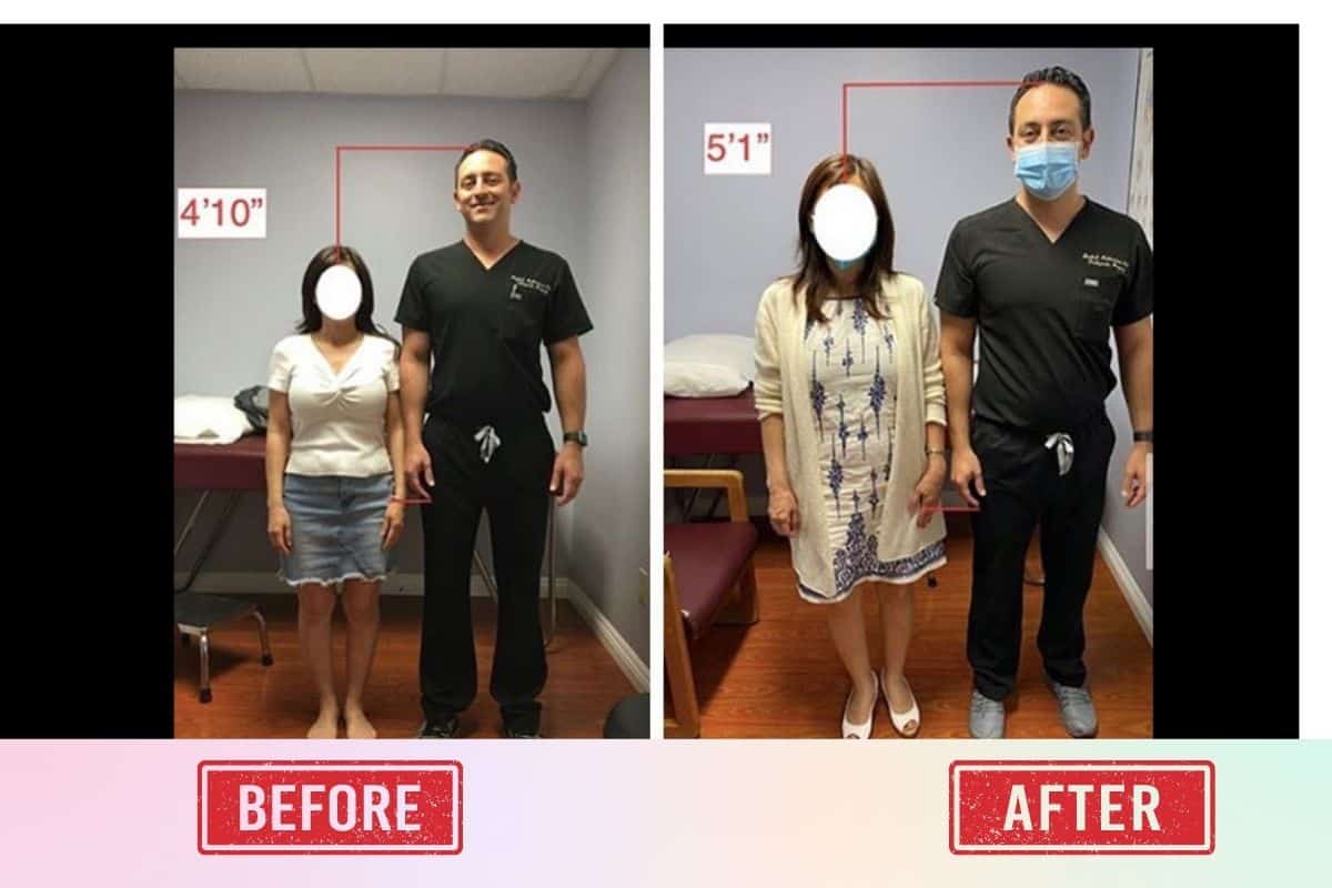 How many inches can you grow with Limb Lengthening Surgery