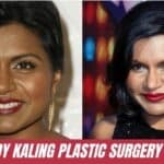 Mindy Kaling Plastic Surgery