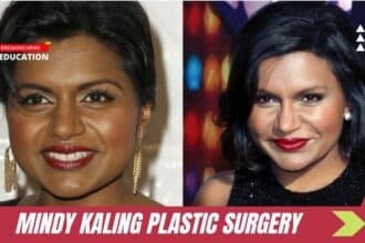 Mindy Kaling Plastic Surgery
