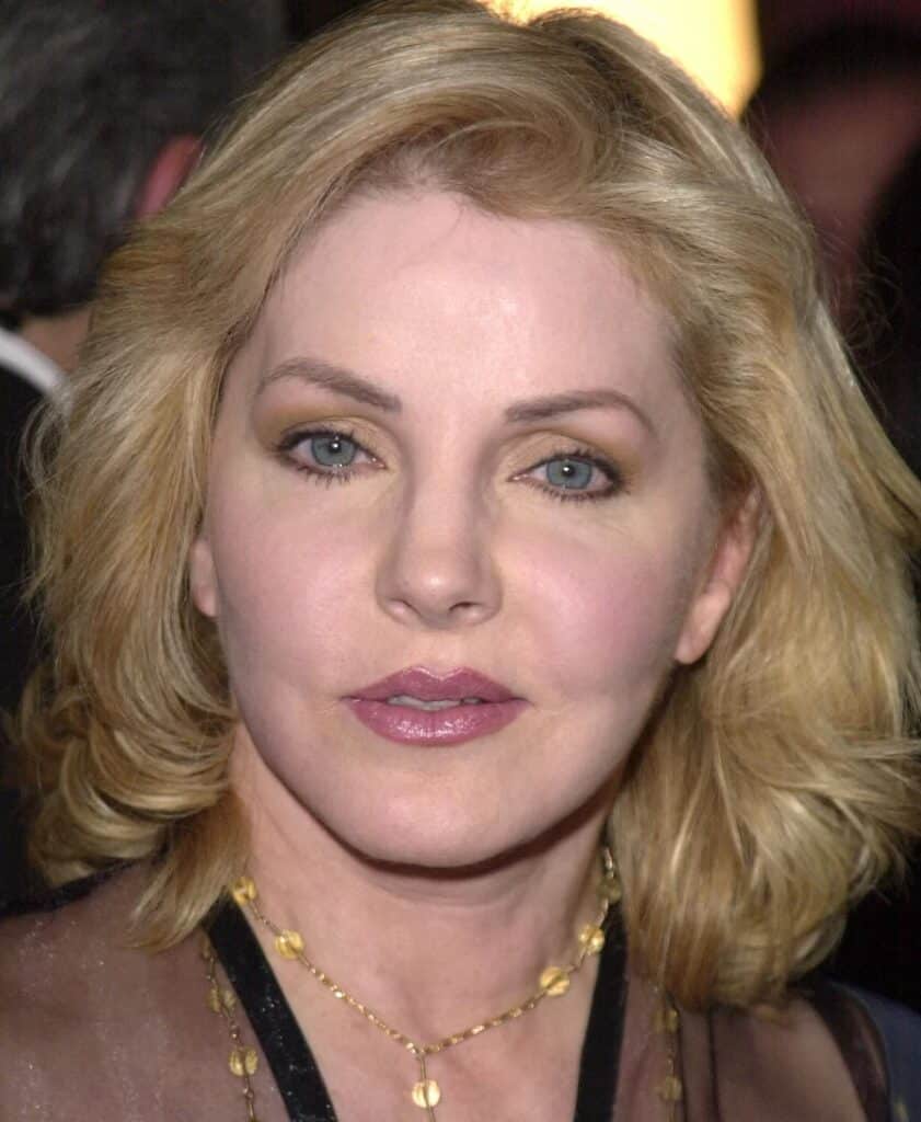 Priscilla Presley Plastic Surgery Photos Over The Years