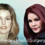 Priscilla Presley Plastic Surgery Photos