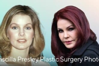 Priscilla Presley Plastic Surgery Photos