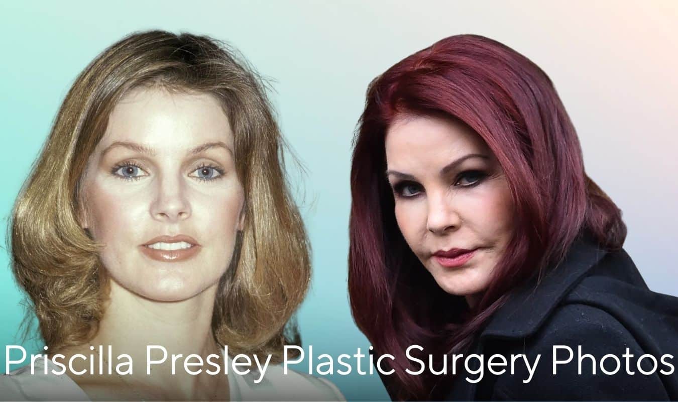 priscilla presley plastic surgery