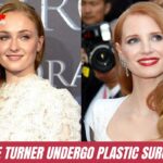 Sophie Turner Plastic Surgery