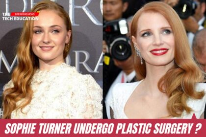 Sophie Turner Plastic Surgery