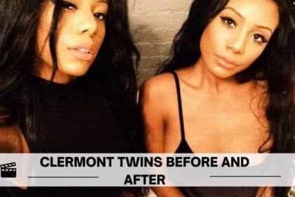 clermont twins before and after