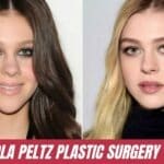 nicola peltz plastic surgery