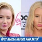 iggy azalea before and after