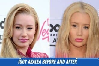 iggy azalea before and after