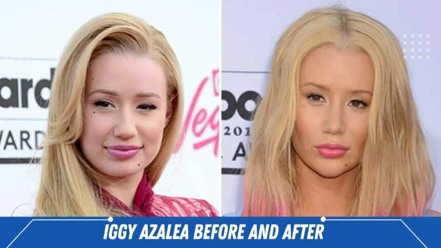 iggy azalea before and after
