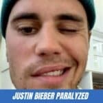 justin bieber paralyzed