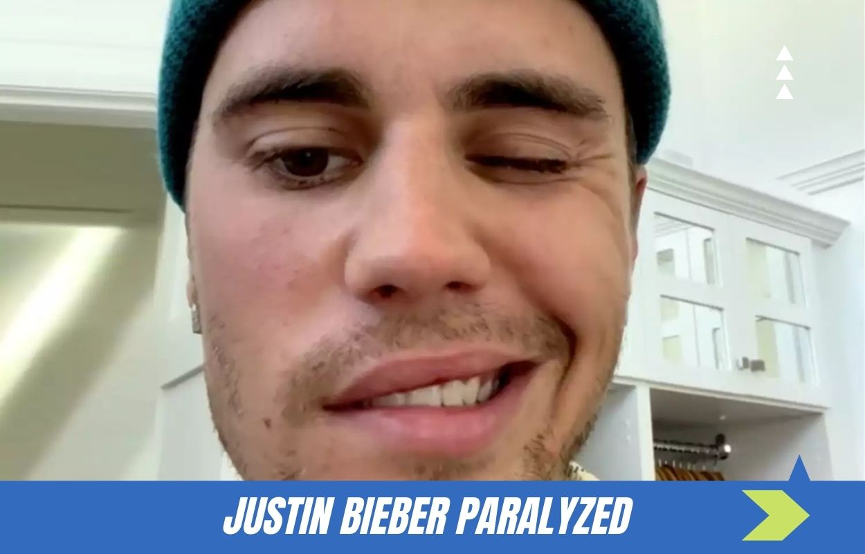 Justin Bieber Paralyzed: Justin Bieber Gives An Update On The Paralysis In His Face.