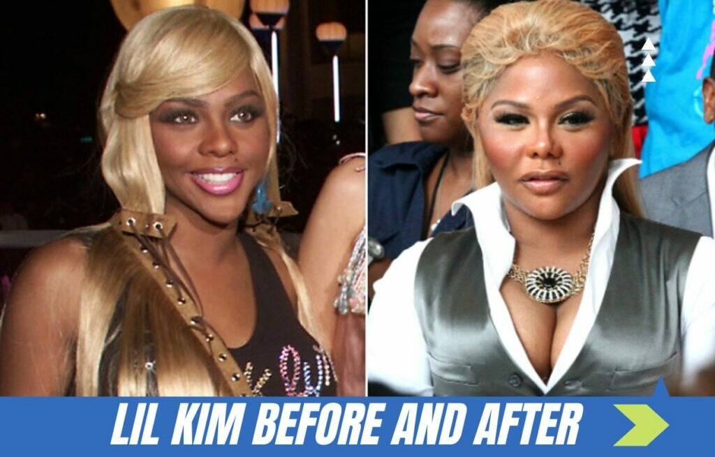 lil kim before and after