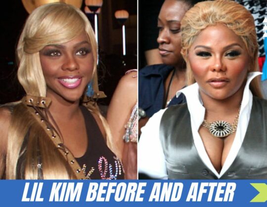 Lil Kim Before And After: How Many Face Surgeries Did Lil Kim Have?