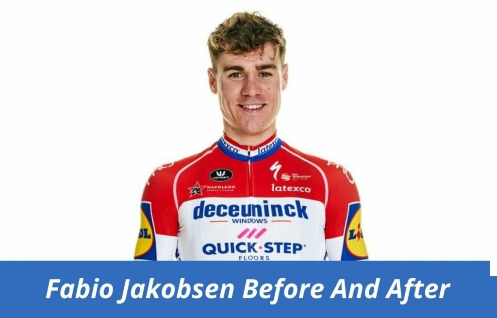 fabio jakobsen before and after