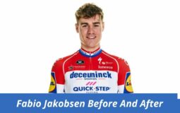 Fabio Jakobsen Before And After: In His Latest Surgery, Fabio Jakobsen Shows Off 10 “Amazing” New Teeth.