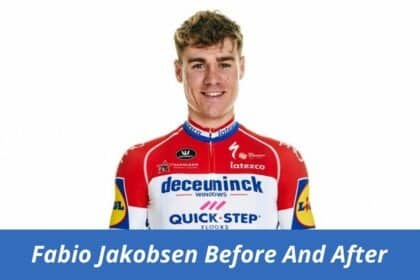 fabio jakobsen before and after