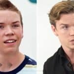 Will Poulter Before And After