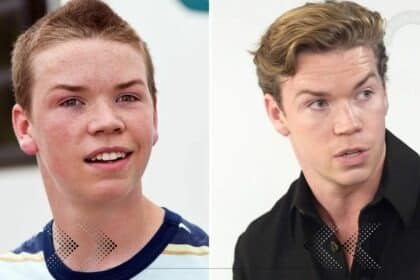 Will Poulter Before And After