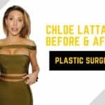 chloe lattanzi before & After plastic surgery