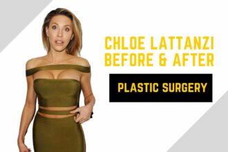 chloe lattanzi before & After plastic surgery