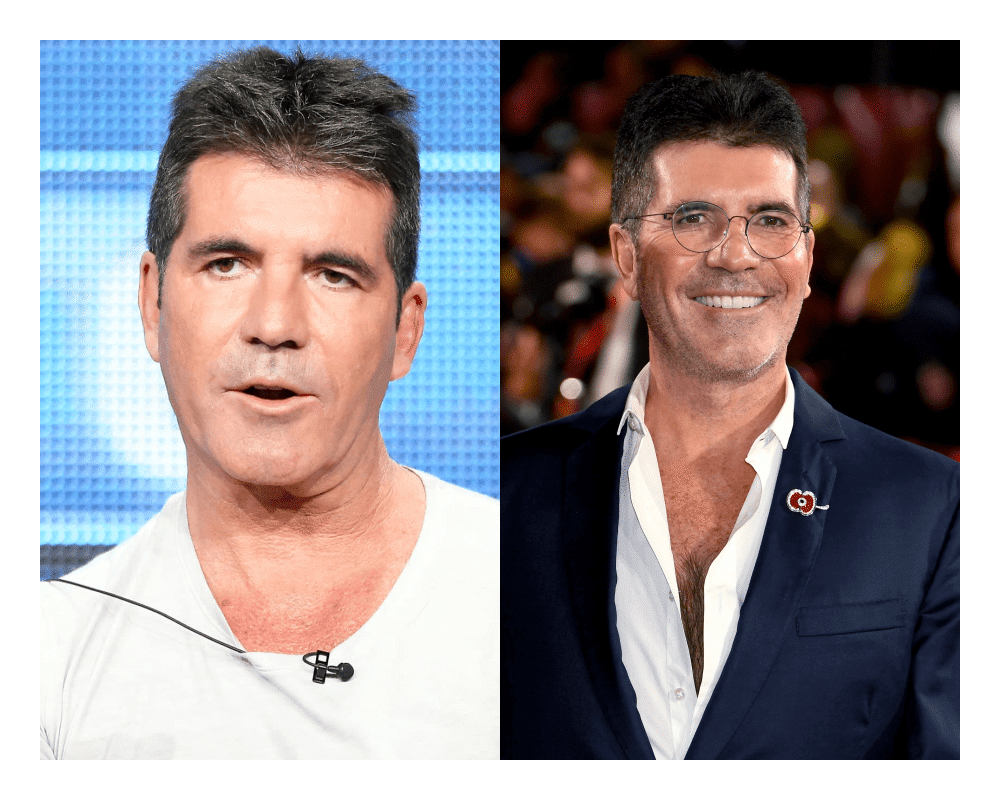 simon cowell before and after