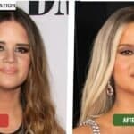Maren Morris Before And After