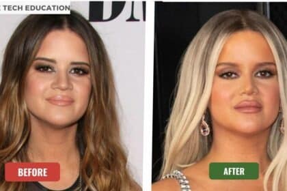 Maren Morris Before And After