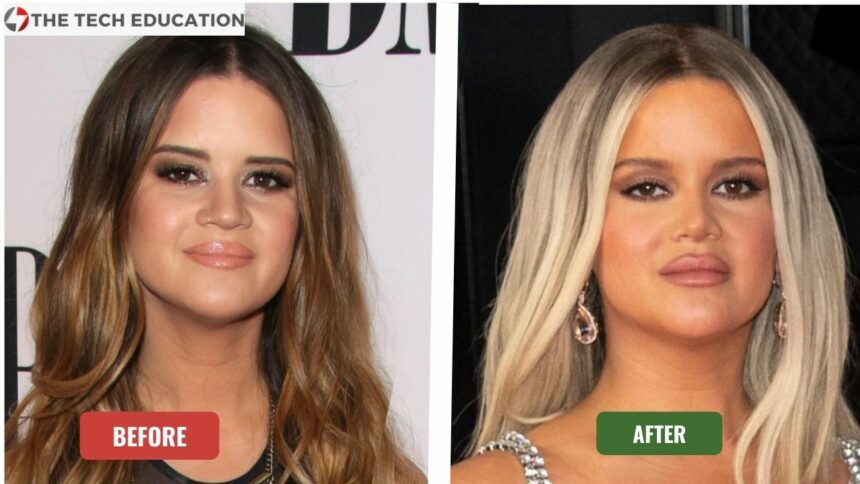Maren Morris Before And After