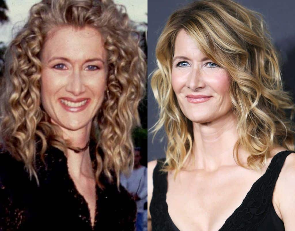 Laura Dern Plastic Surgery Images Before And After What Kind Of Surgery She Takes