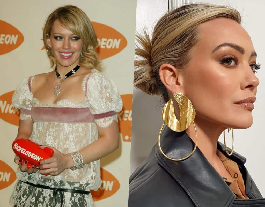 hilary duff veneers before after