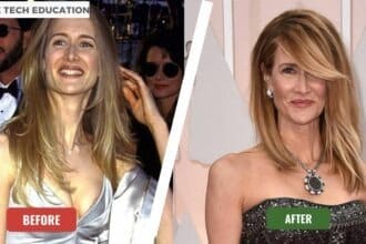 laura dern before and after