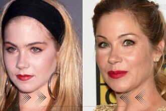 Christina Applegate Plastic Surgery