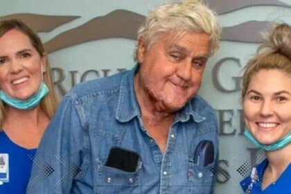 Jay Leno released from hospital after suffering burns