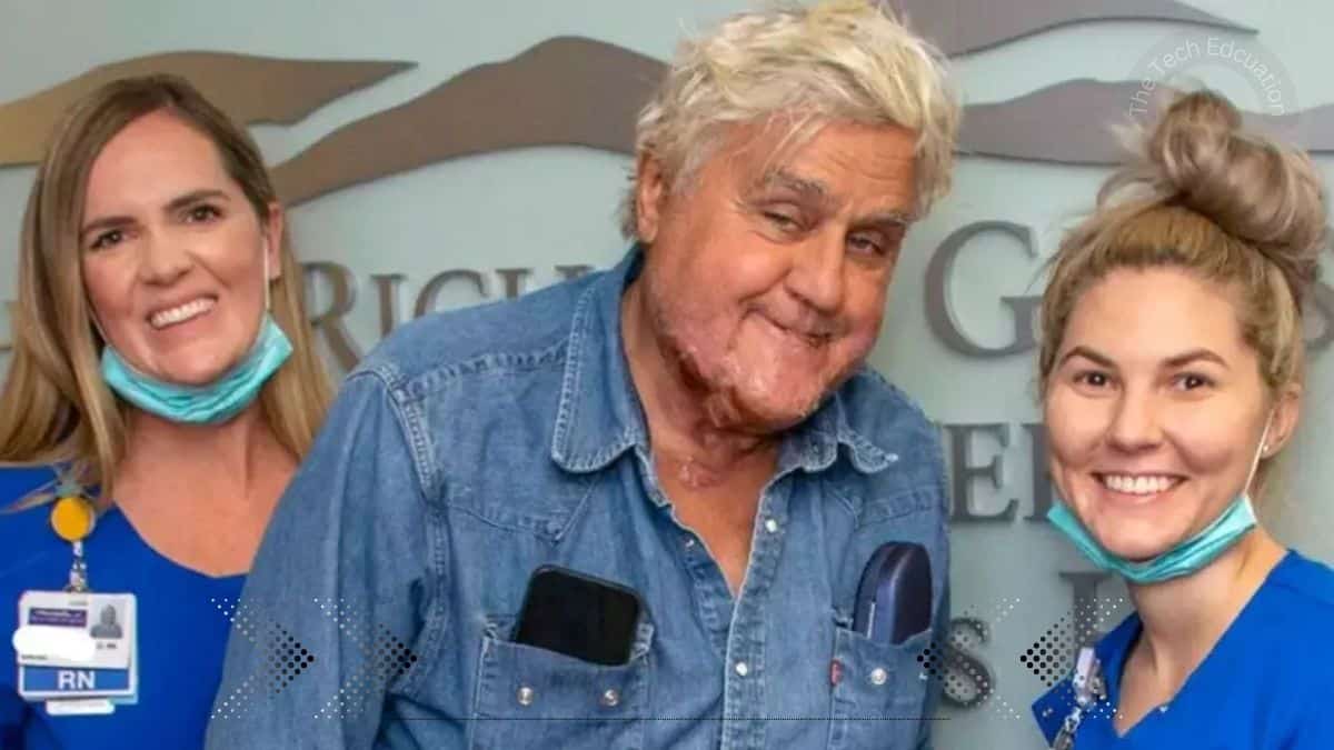 Jay Leno released from hospital after suffering burns