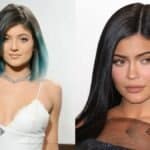 Kylie Jenner Before Surgery