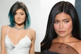 Kylie Jenner Before Surgery