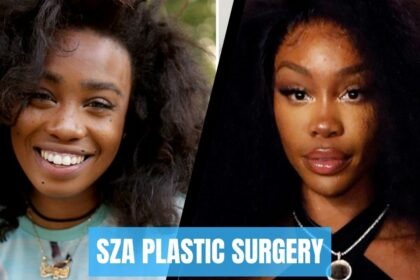 sza plastic surgery