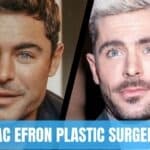 zac efron plastic surgery