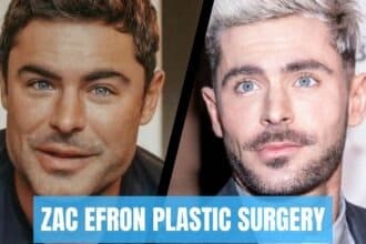 zac efron plastic surgery