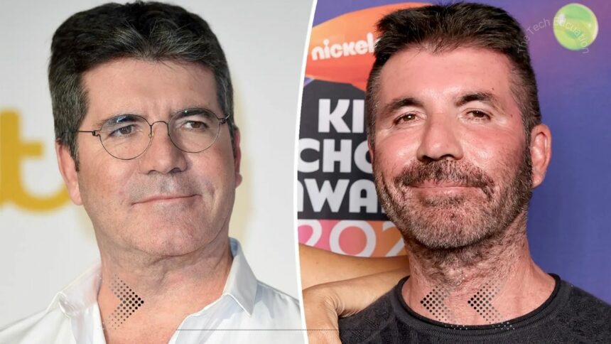 What Kind Of Plastic Surgery Did Simon Cowell Have?
