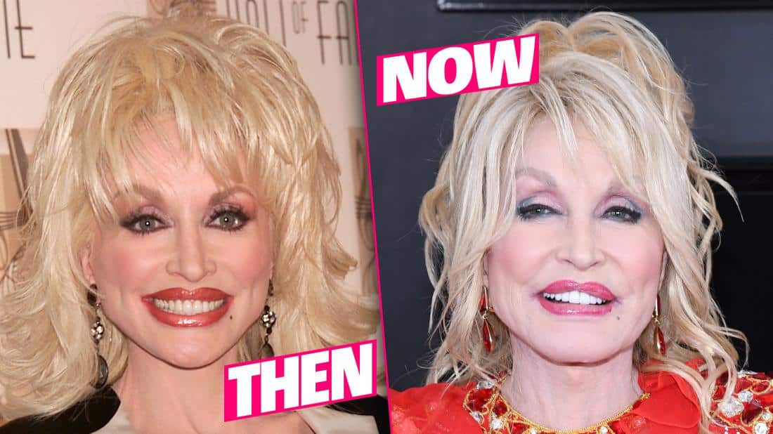 Dolly Parton's Plastic Face Fiasco Revealed In Shocking New Photos