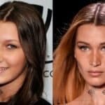 Bella Hadid Before Surgery