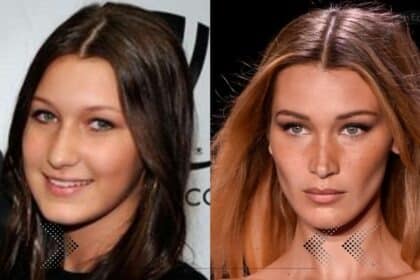 Bella Hadid Before Surgery